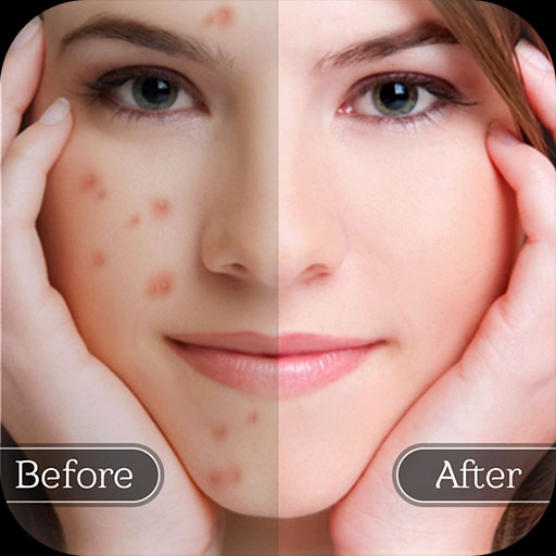 نرم‌ افزار Face Blemish Remover